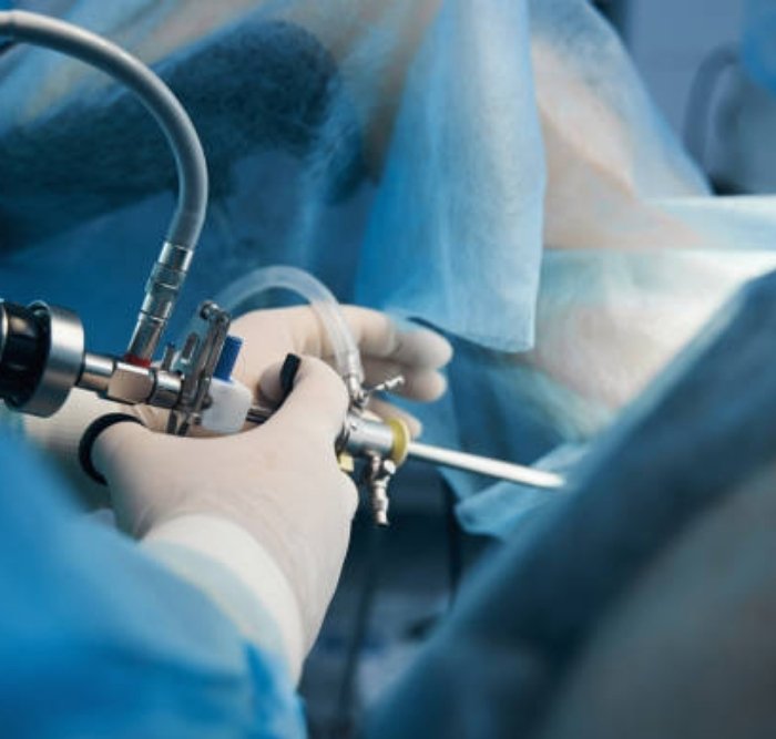 Laparoscopic Surgery