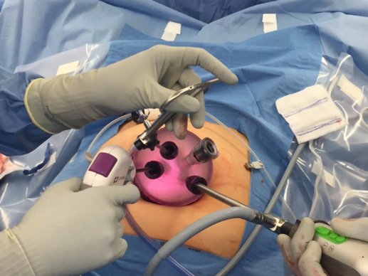 Gynecological Oncology