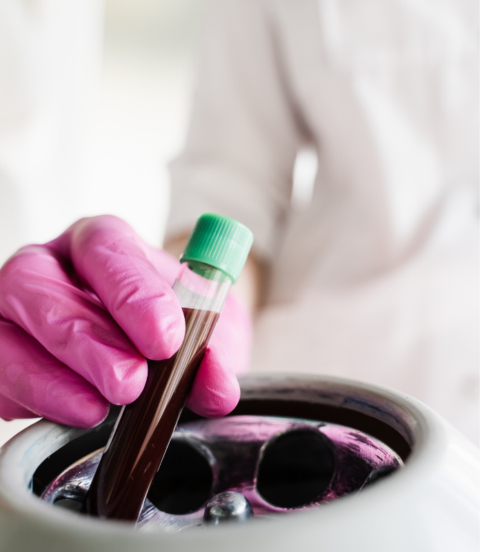 PRP Therapy for Pelvic Health