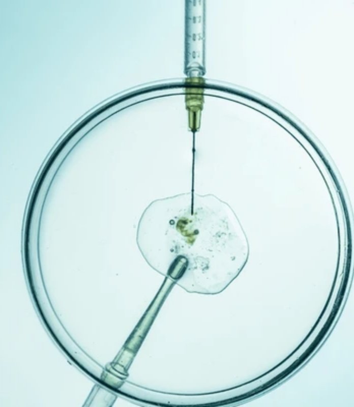 Assisted Reproductive Technologies (ART)