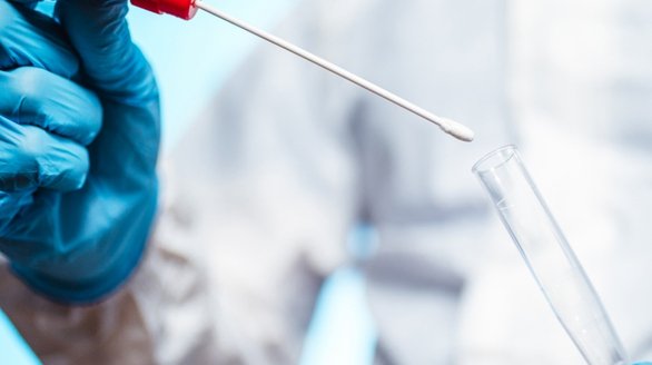 Sperm Washing and Preparation