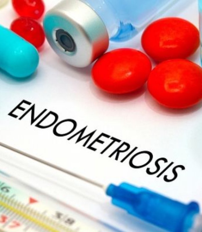endometeriosis