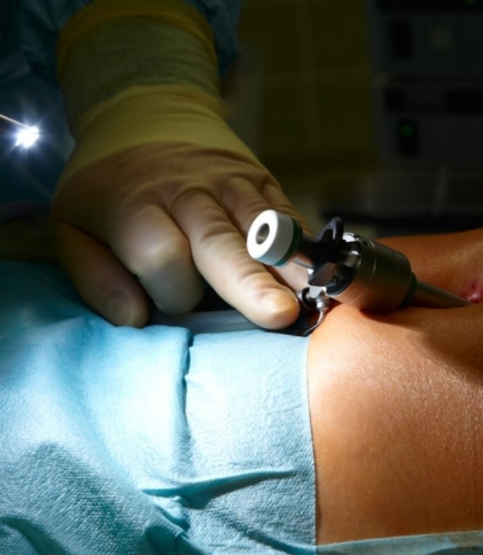 laparoscopic