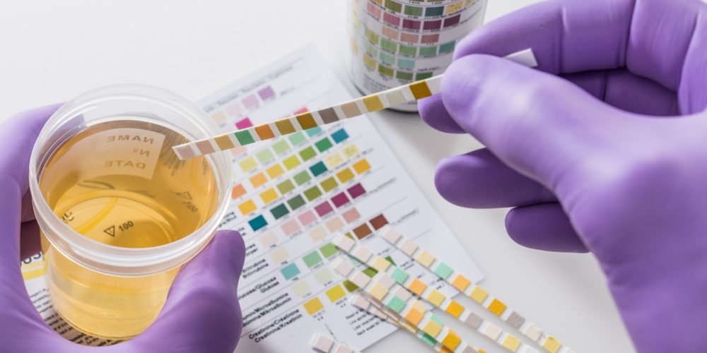 UTIs are Caused and Diagnosed