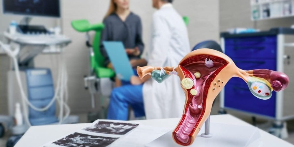 Diagnose Gynecological Cancers